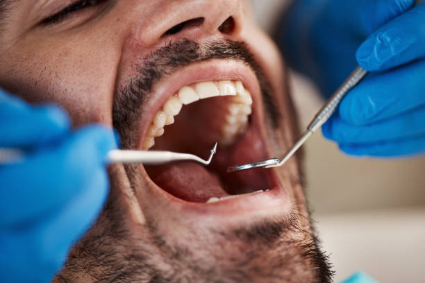 Best Emergency Treatment for Toothache in Whitehall, WI